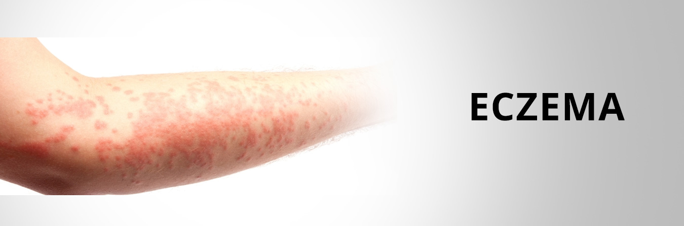 Derma Care Mangalore