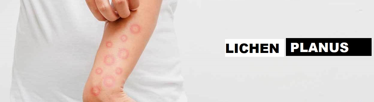 Derma Care Mangalore